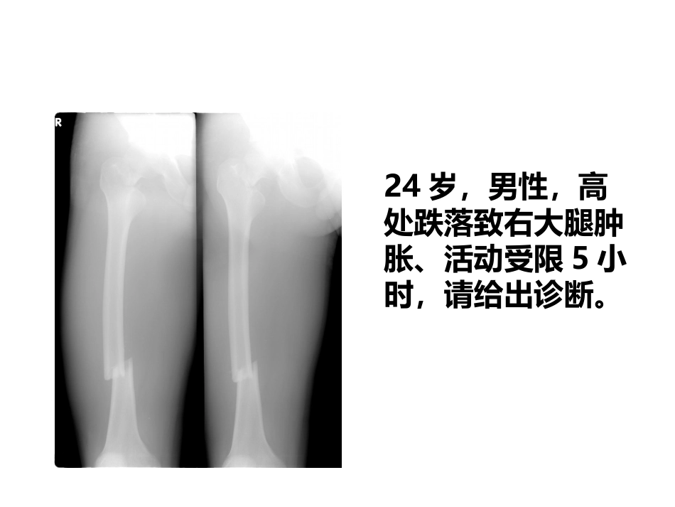 骨科基本技术_第3页