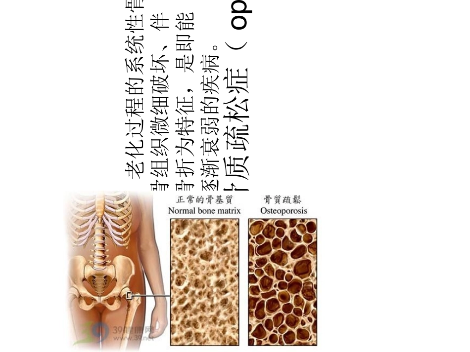 骨科月份业务学习_第3页
