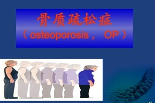 骨质疏松症p
