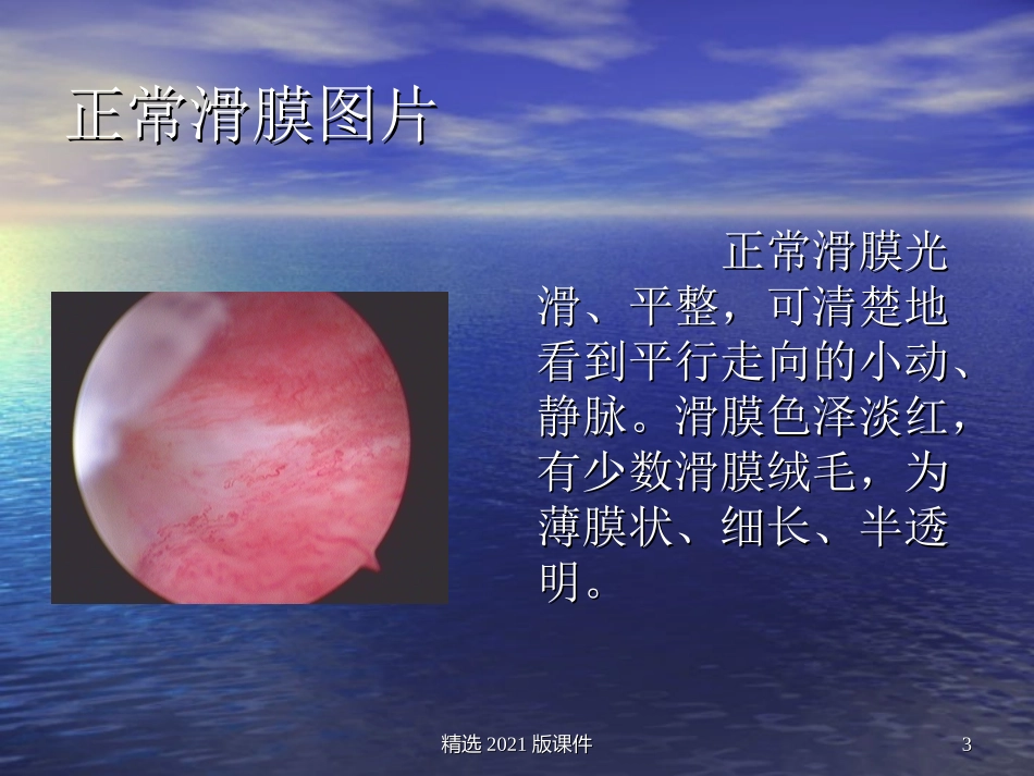 关节镜下滑膜切除术_第3页