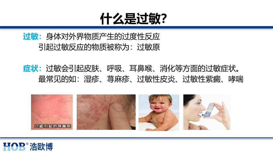过敏原检测和常见问题分析_第2页