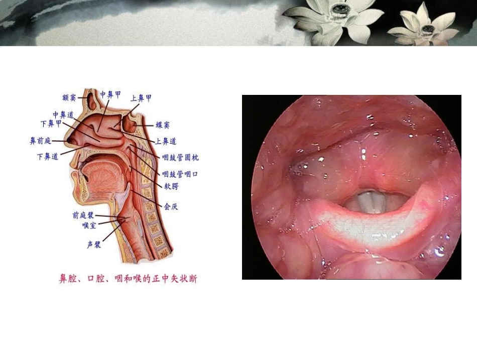 喉炎病人的护理_第3页