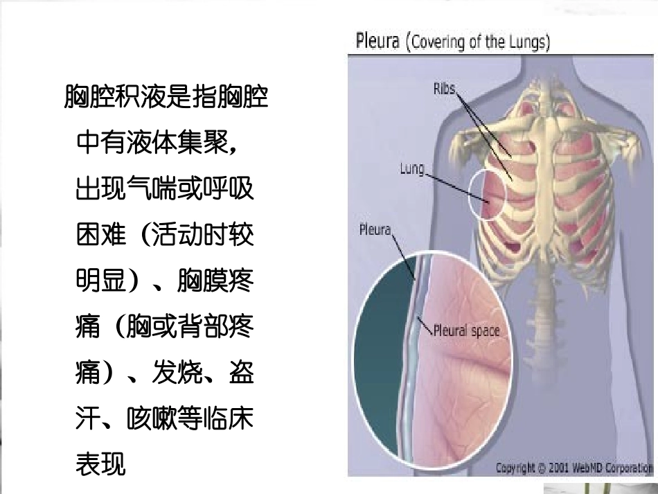 呼吸内科教学查房胸腔积液医学课件_第2页