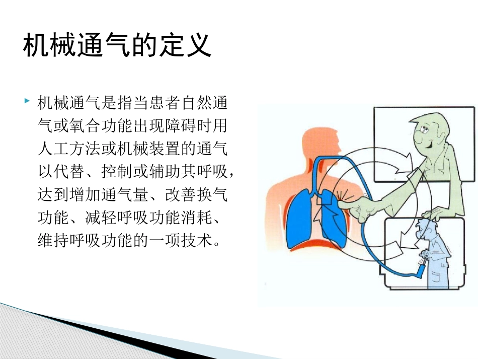 机械通气的护理要点说明_第2页