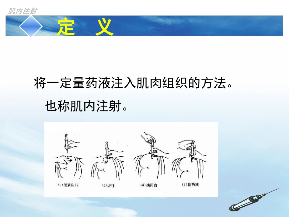 肌肉注射的管理和治疗_第3页