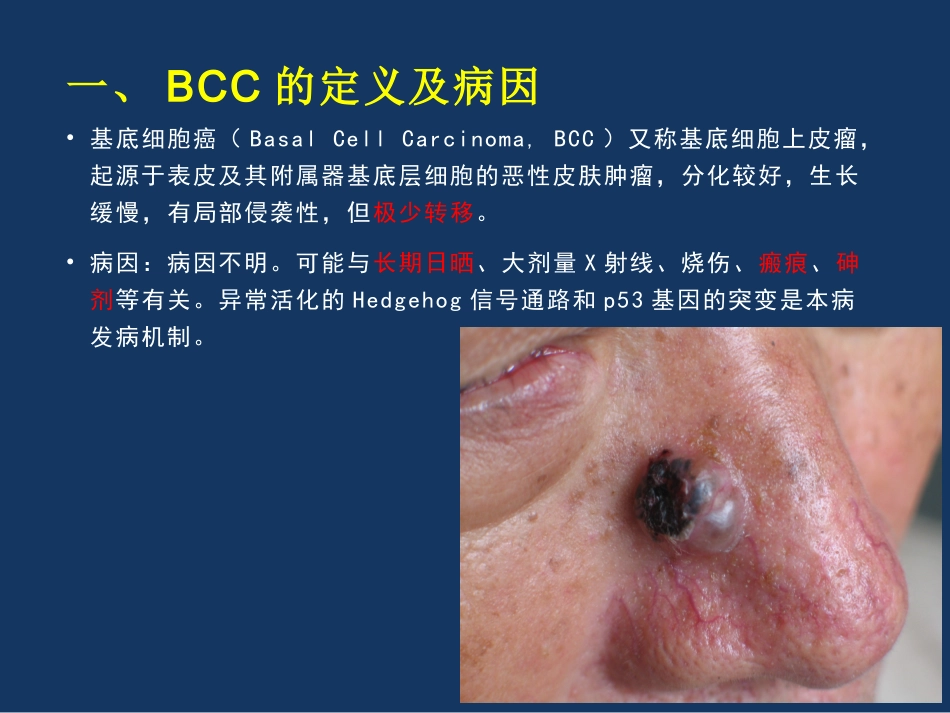 基底细胞癌赖俊东_第3页