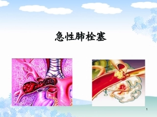 急性肺栓塞诊治和护理