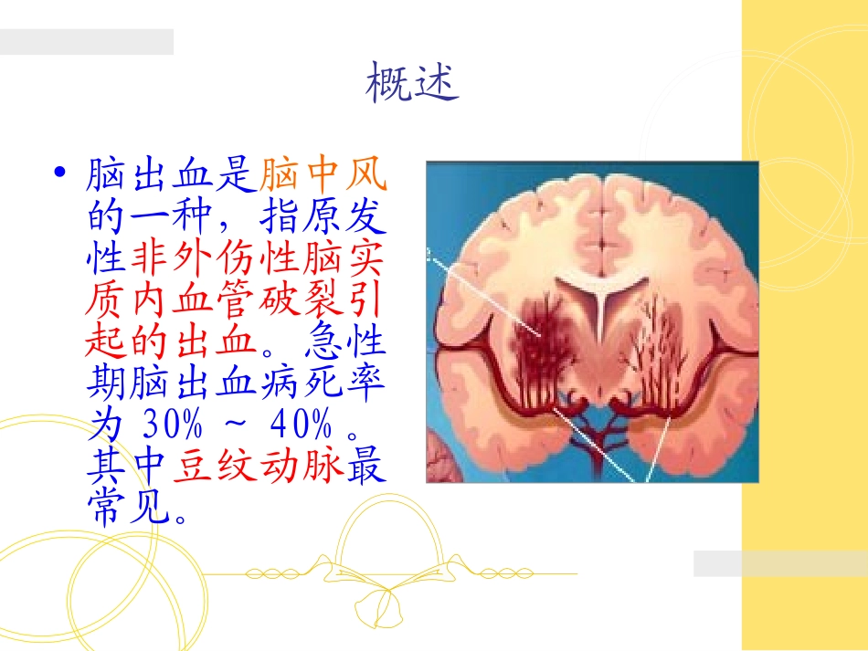 急诊脑出血的观察和护理程序诊疗治疗_第2页
