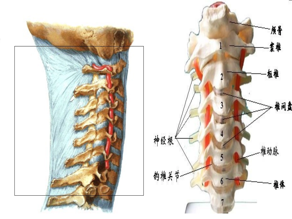 脊髓型颈椎病患者的个案护理查房_第2页