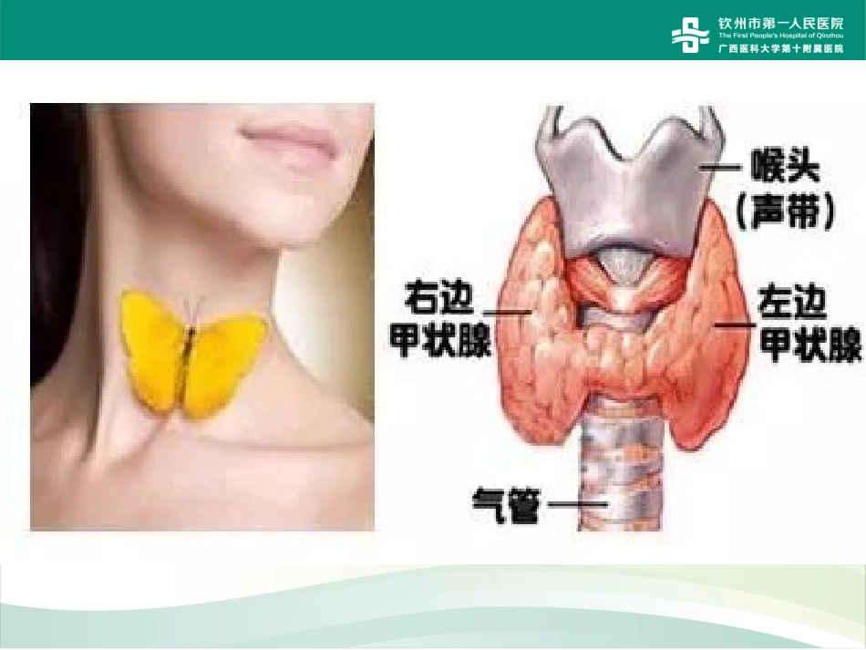 甲状腺癌术后饮食指导建议_第2页