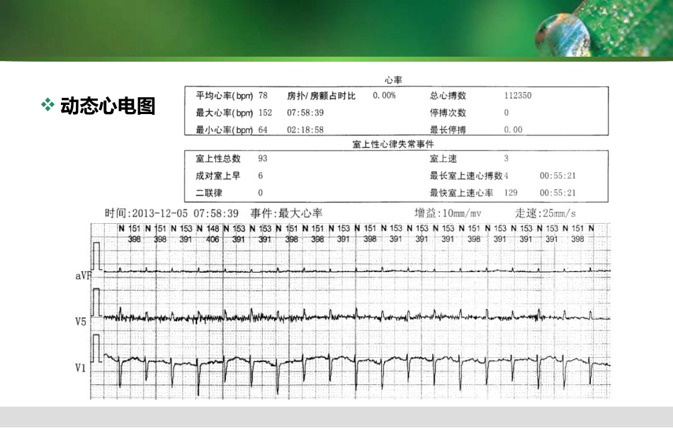 甲状腺功能亢进性心脏病_第3页