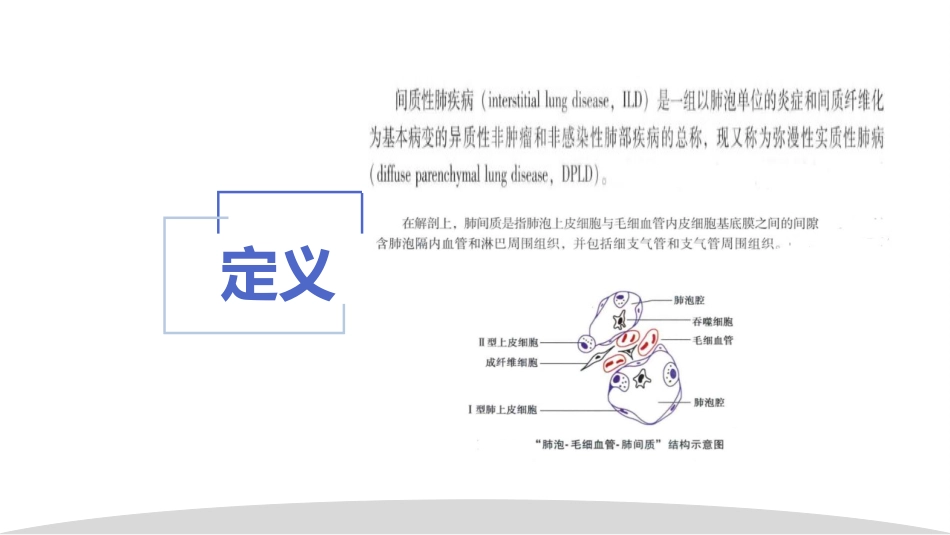 间质性肺疾病概述_第3页