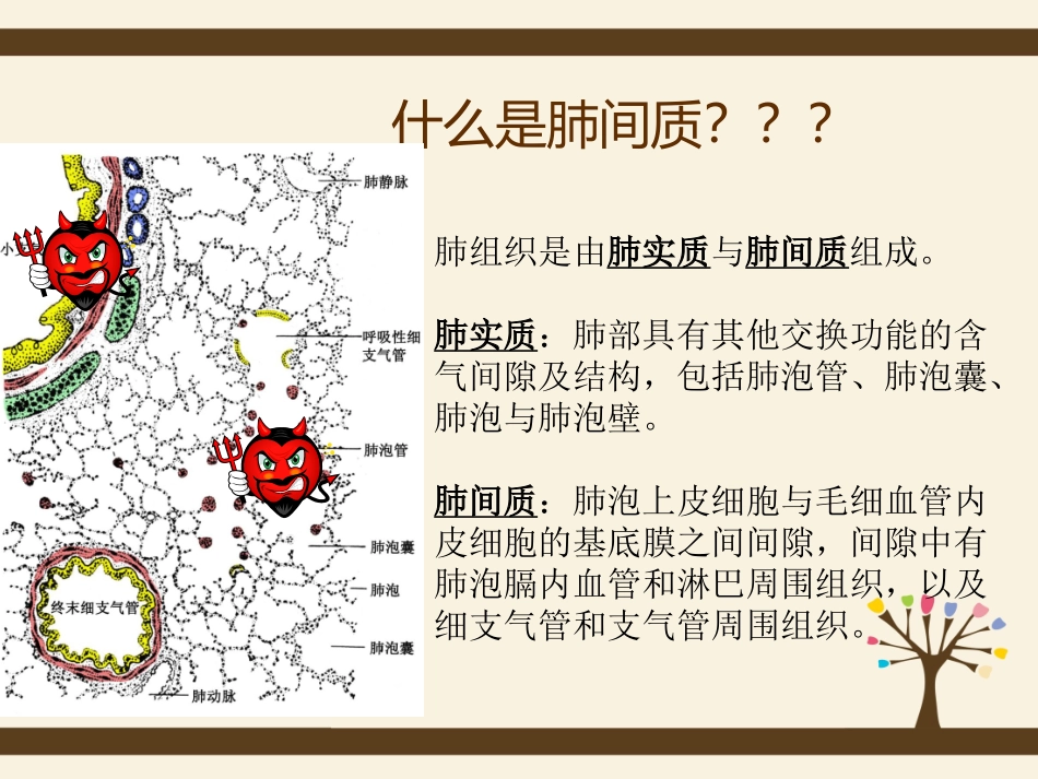 间质性肺炎护理查房课件_第3页