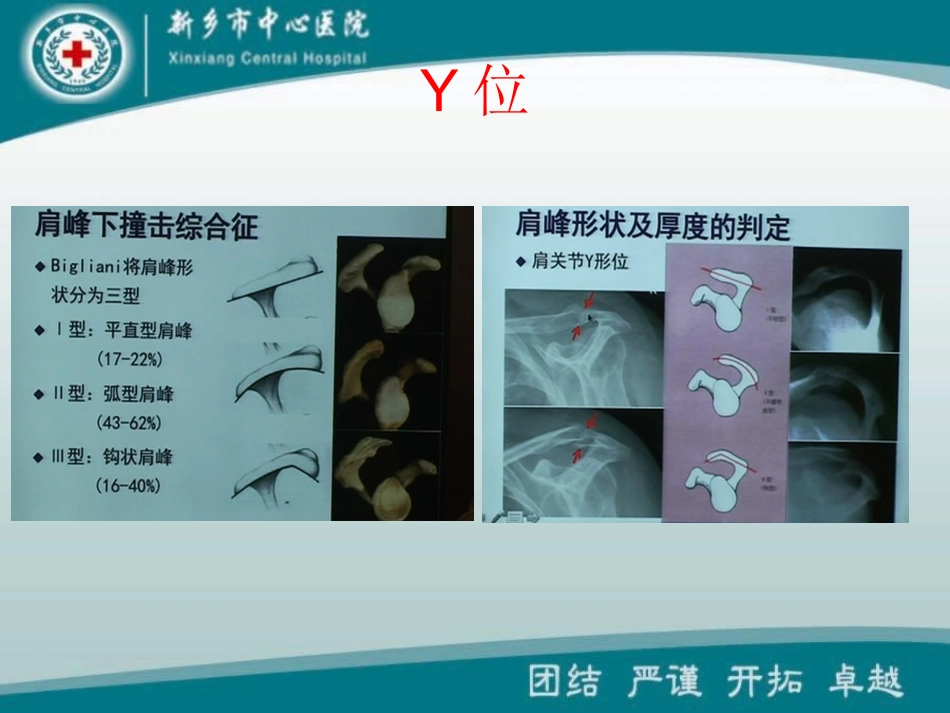 肩膝髋特殊体位拍片技巧_第3页