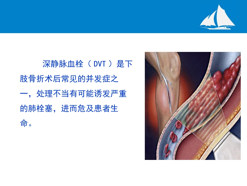 降低下肢深静脉血栓的发生率_第2页