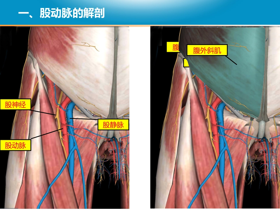 经皮股动脉穿刺术后压迫止血的护理配合_第3页