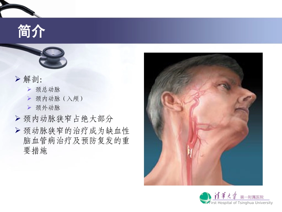 颈动脉狭窄的诊疗治疗_第2页