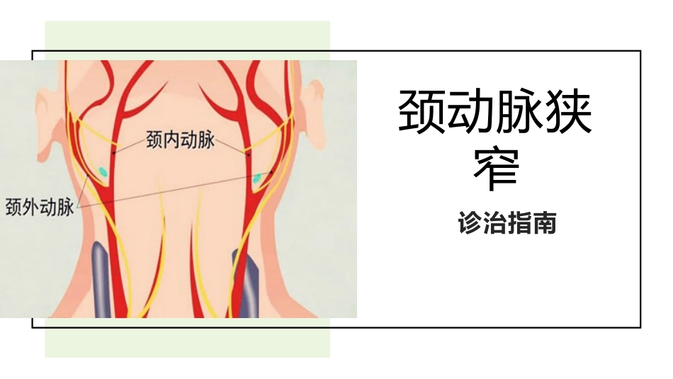 颈动脉狭窄诊治指南_第1页