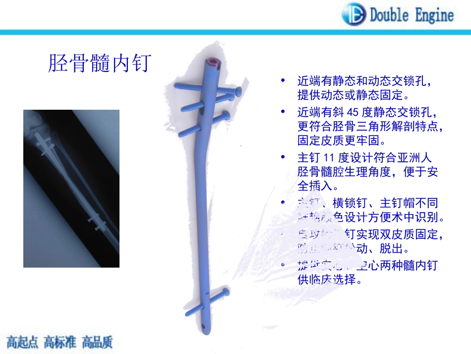 胫骨髓内钉课件_第2页