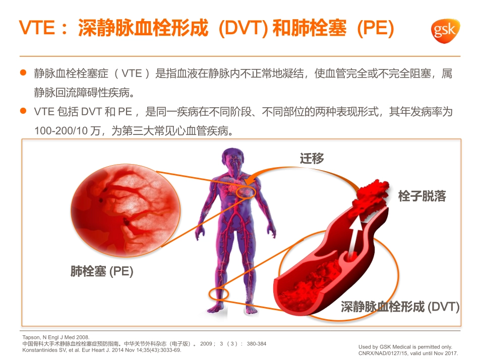 静脉血栓栓塞症的早期诊疗和治疗_第3页