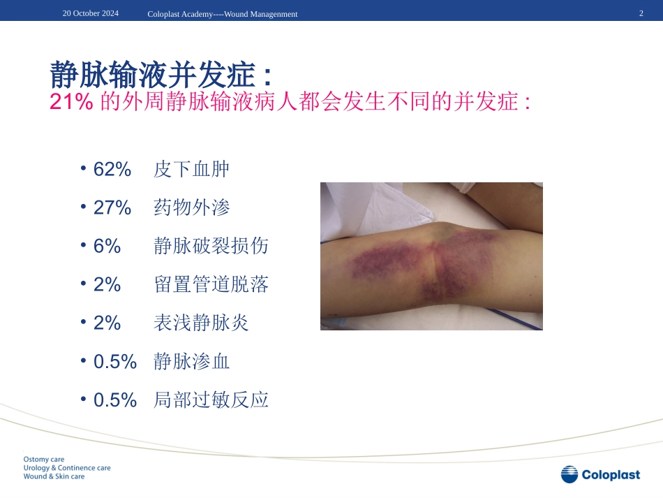 静脉炎的预防和处置课件_第2页