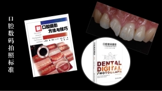 口内外数码拍照标准