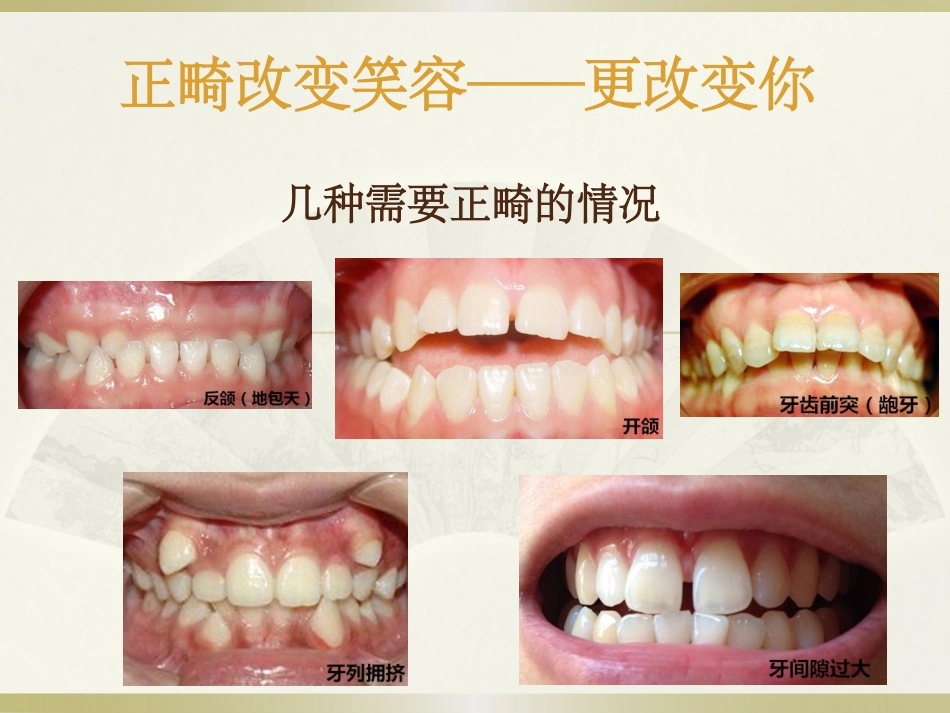 口腔正畸沟通模板_第3页