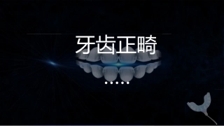 口腔正畸介绍