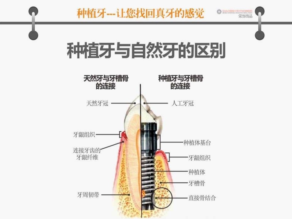 口腔种植及修复医患沟通图谱_第3页