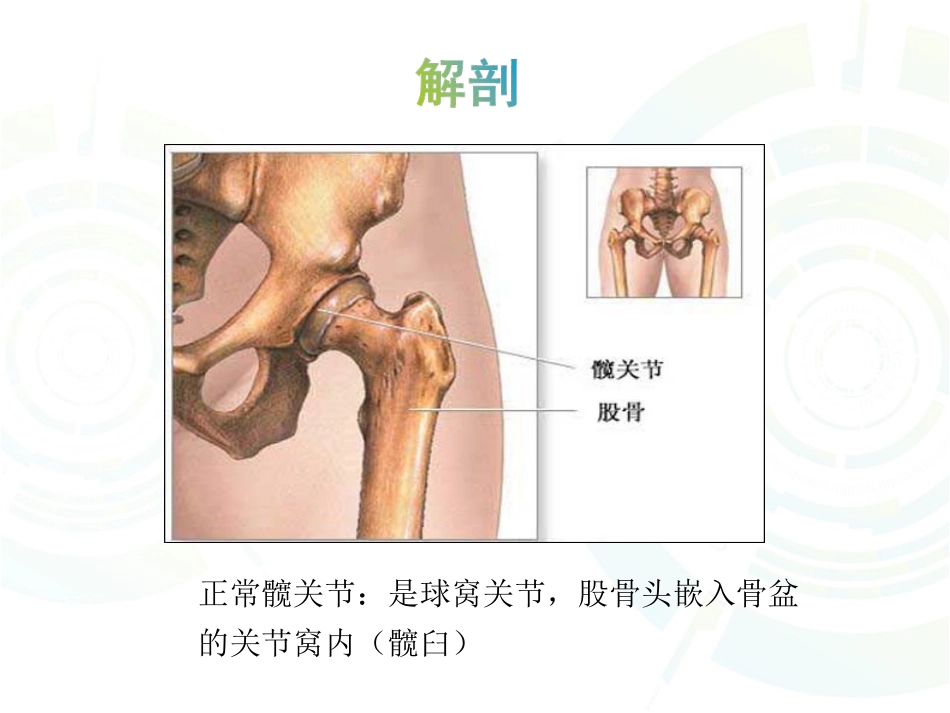 髋骨关节炎祖_第2页