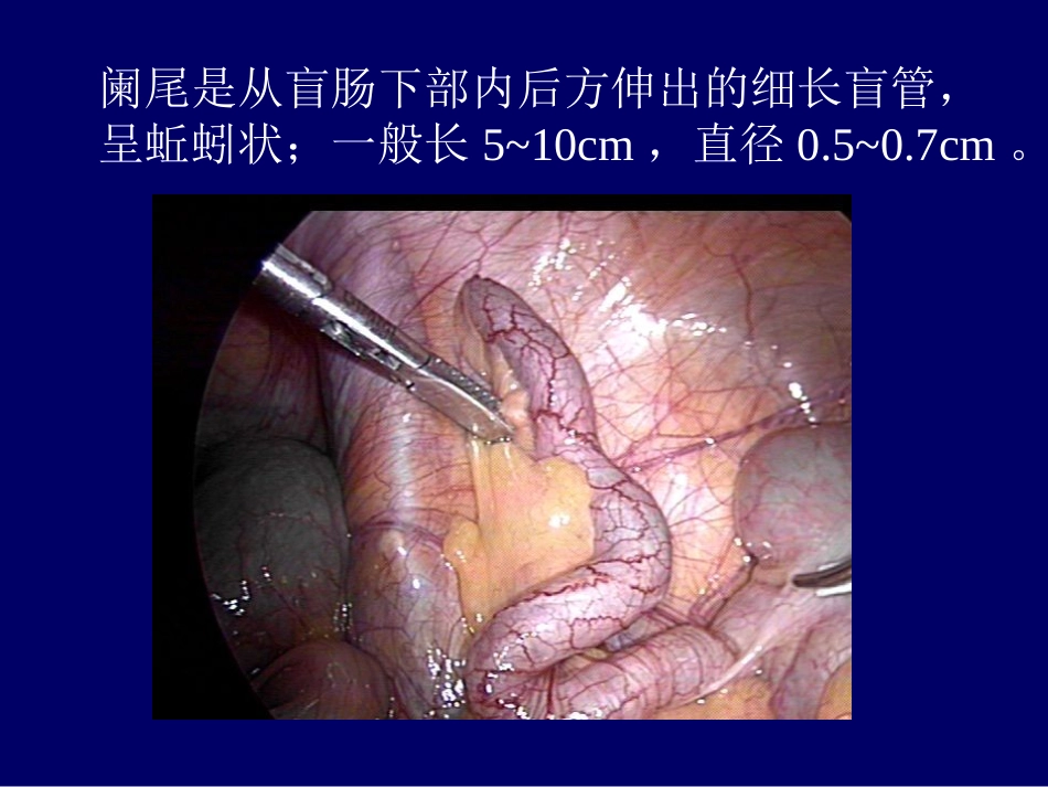 阑尾周围脓肿给药_第3页