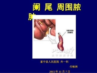 阑尾周围脓肿给药