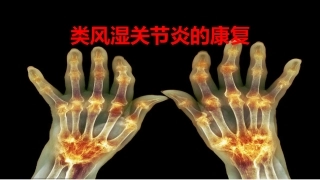 类风湿关节炎的康复