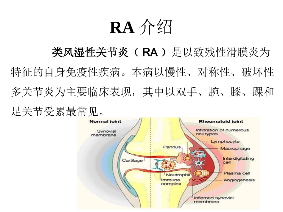 类风湿关节炎发病机制_第3页
