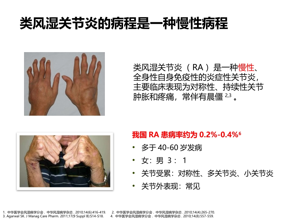 类风湿关节炎治疗和管理_第3页