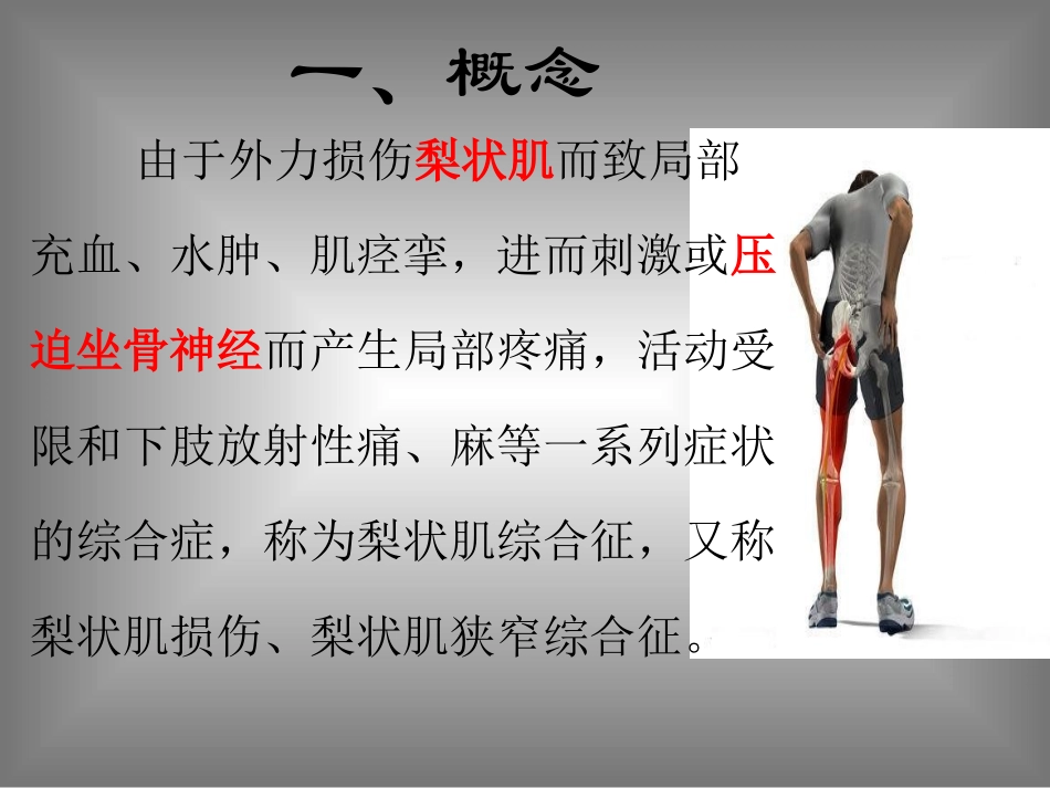 梨状肌综合征_第2页