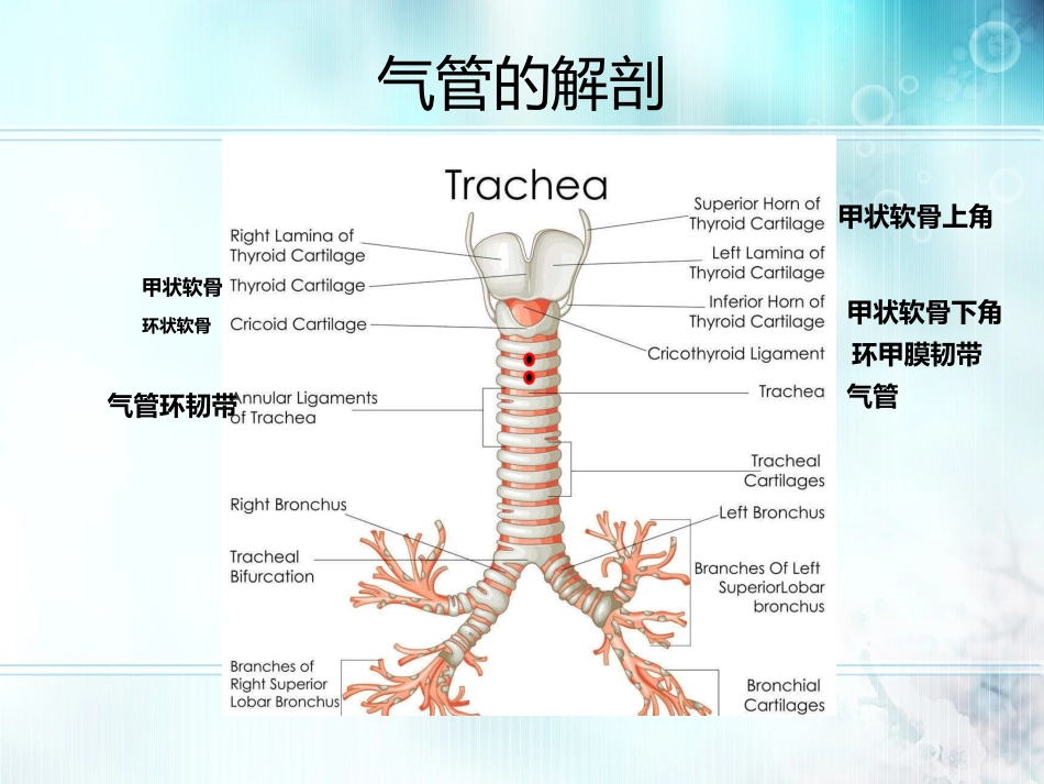 李刚经皮气管切开_第3页