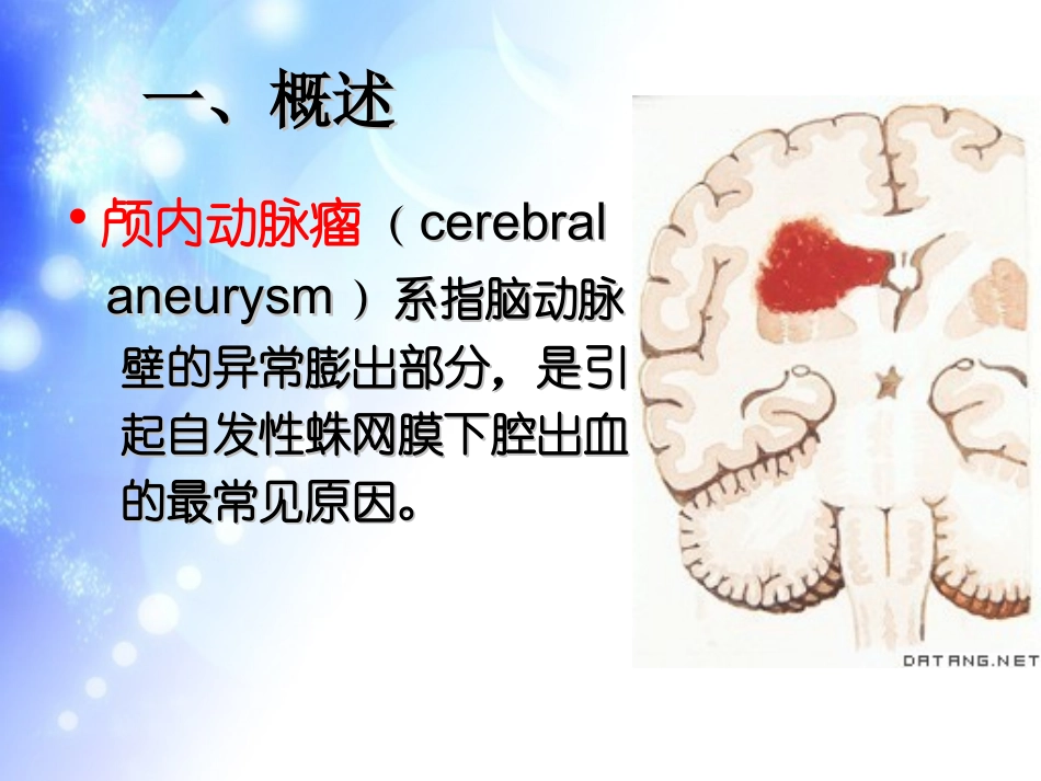 颅内动脉瘤手术前后的护理_第2页