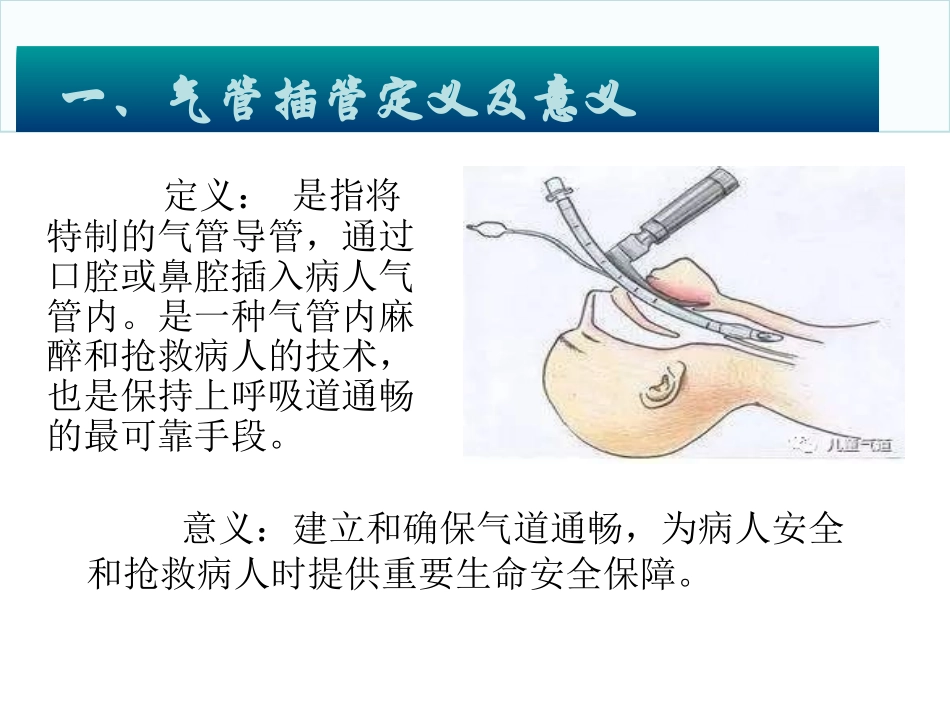 麻醉科气管插管_第3页
