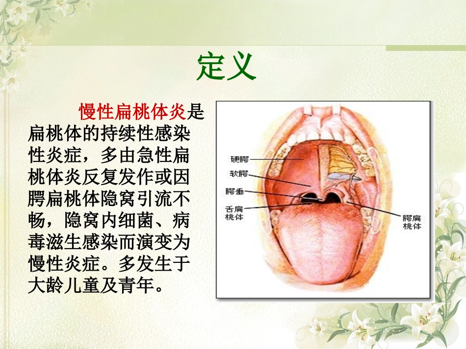 慢性扁桃体炎幻灯片课件_第2页