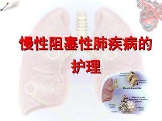 慢性阻塞性肺疾病的护理