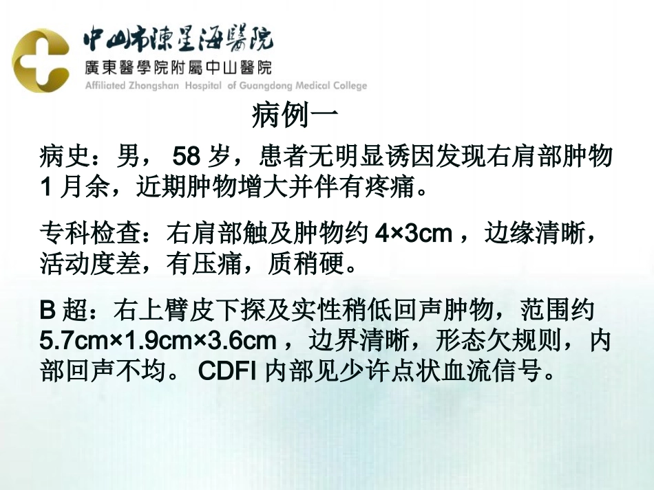 米粒体滑膜炎影像表现_第2页