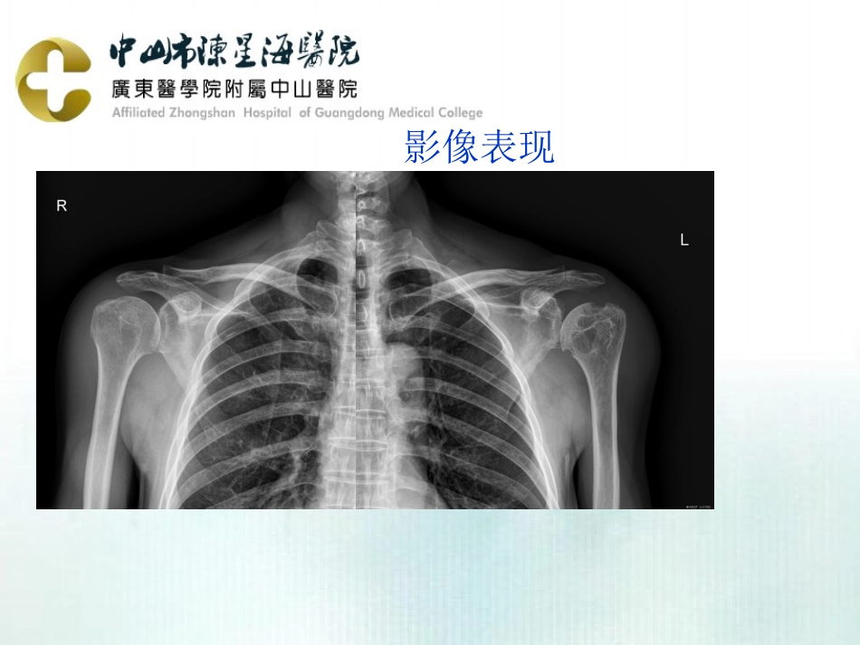 米粒体滑膜炎影像表现_第3页