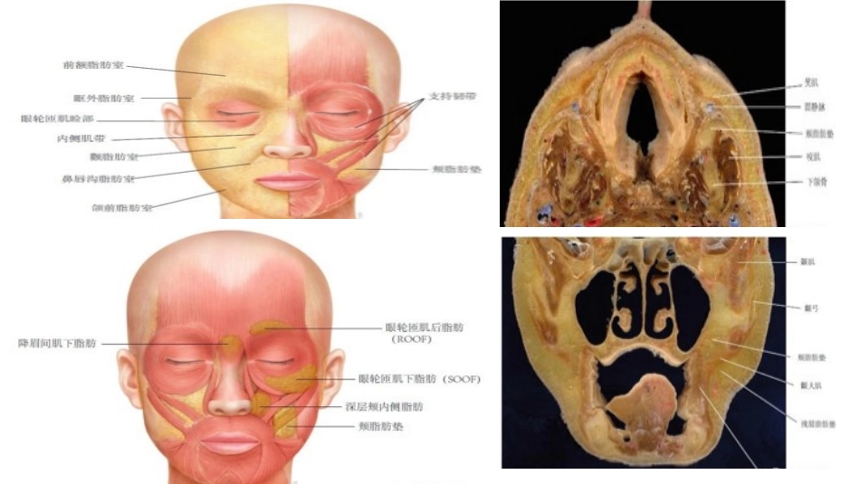 面部表情肌解剖_第3页
