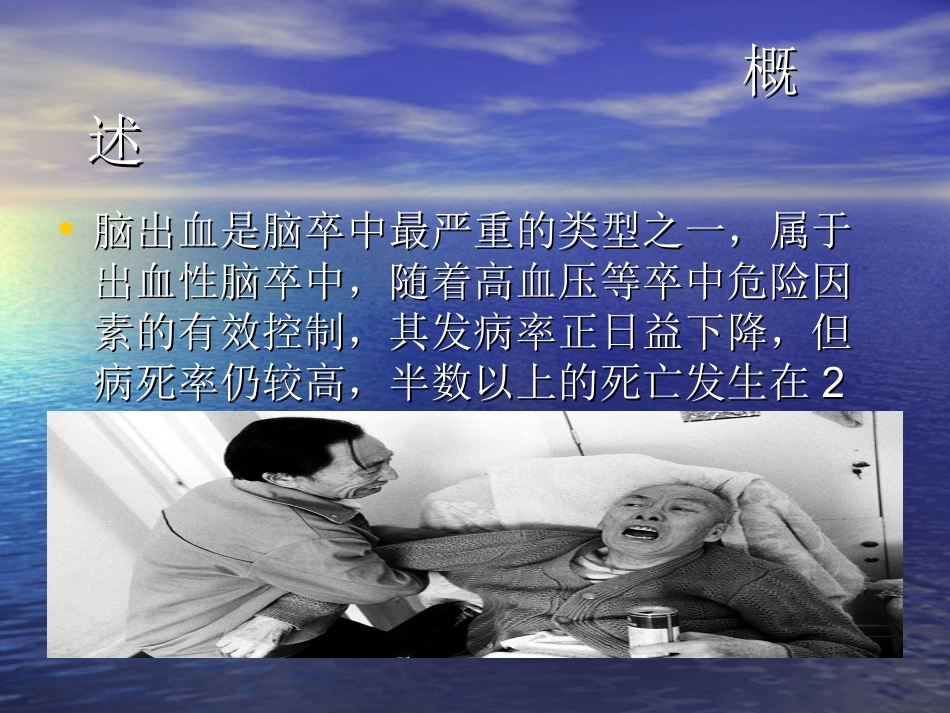 脑出血的护理常规_第2页