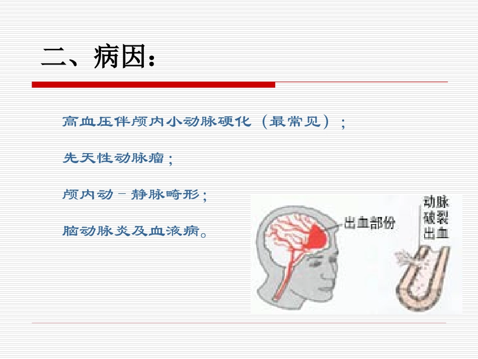 脑出血业务学习_第3页