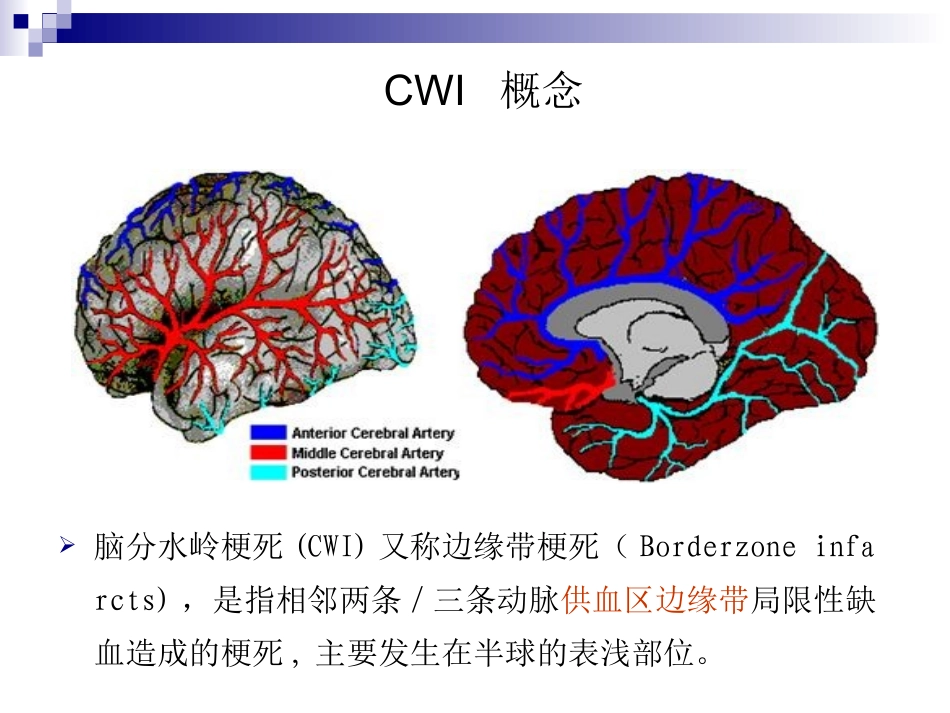 脑分水岭梗死jason_第2页