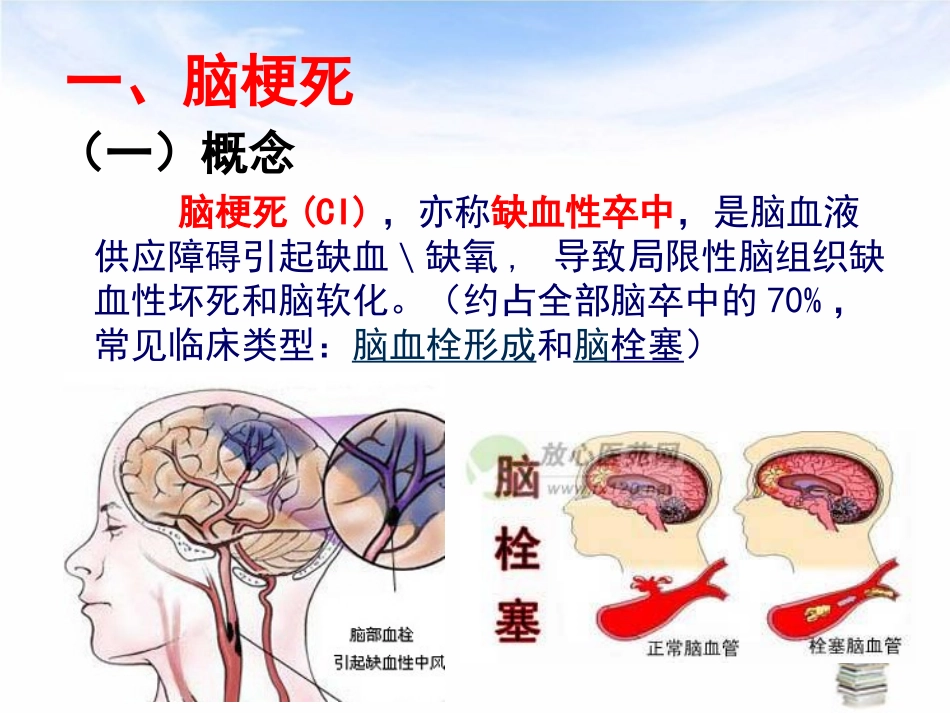 脑梗死相关护理知识_第3页