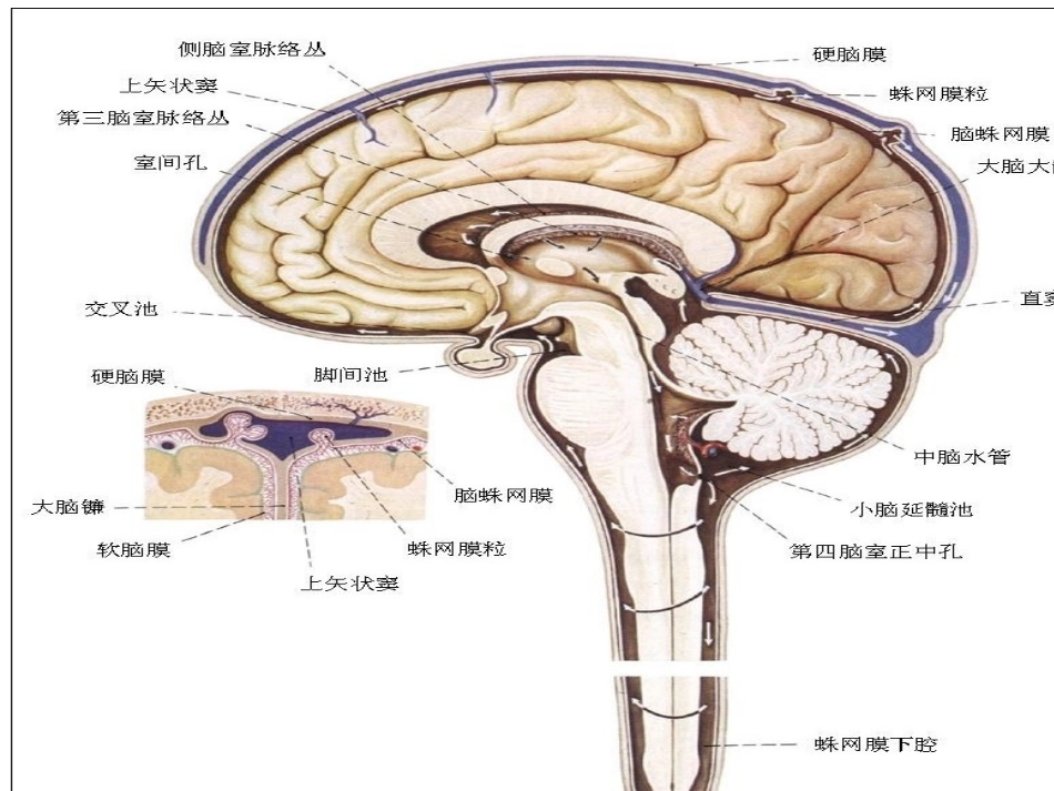 脑脊液耳漏的护理课件_第3页
