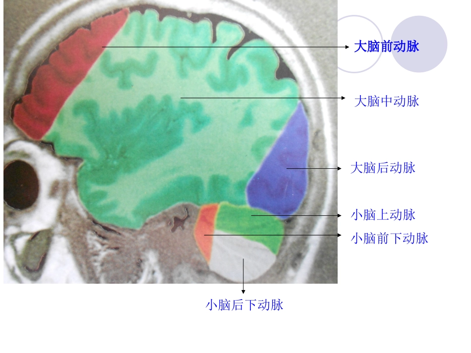 脑血管分布示意图_第2页